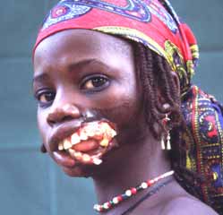 Description: FacingAfrica-GirlWithNOMA-1.jpg