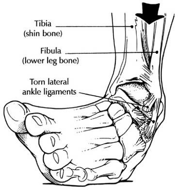 Description: ankle.jpg