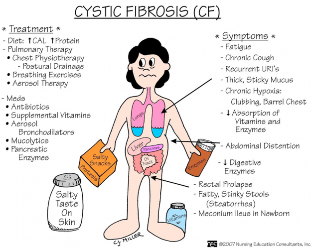 Cystic Fibrosis Nursing Tutorials
